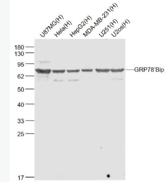 Anti-GRP78/Bip antibody-葡萄糖调节蛋白78单克隆抗体,GRP78/Bip
