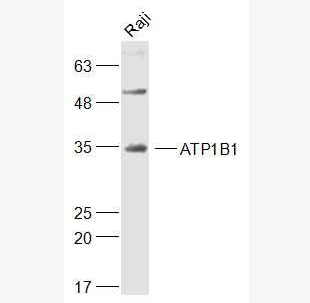 Anti-ATP1B1 antibody-钠钾ATP酶蛋白b1抗体,ATP1B1