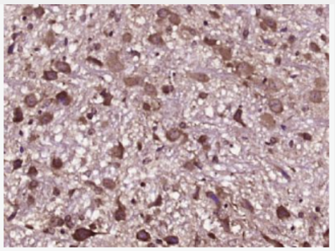 Anti-VDAC antibody-等电压依赖性阴离子通道抗体,VDAC