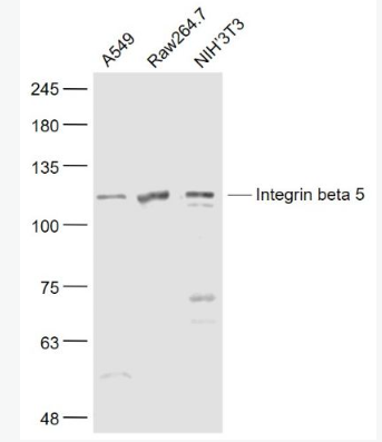 Anti-Integrin beta 5 antibody-整合素β5抗体,Integrin beta 5