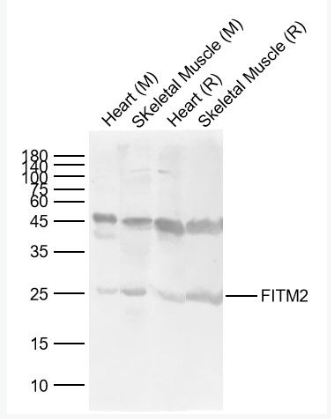 Anti-FITM2  antibody-FITM2蛋白抗體,FITM2