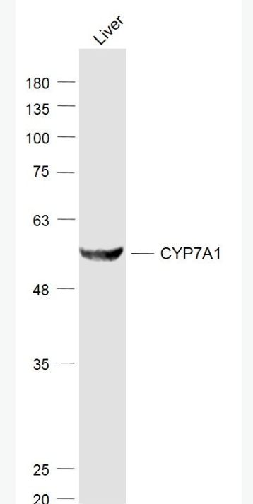 Anti-CYP7A1 antibody-细胞色素P450 7A1抗体/胆固醇7a羟化酶抗体,CYP7A1