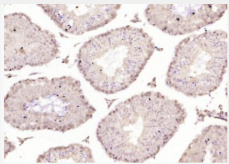 Anti-SOX6 antibody-核转录因子SOX6抗体,SOX6