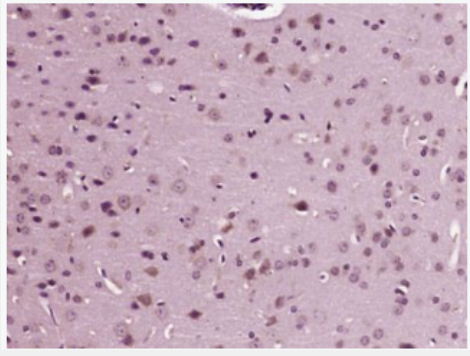 Anti-TRPV1 antibody-辣椒素受体抗体,TRPV1