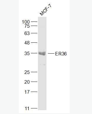 Anti-ER36 antibody-雌激素受體α36抗體,ER36