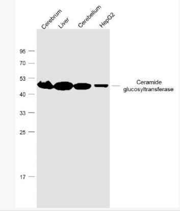 Anti-Ceramide glucosyltransferase antibody-葡萄糖神经酰胺合成酶抗体,Ceramide glucosyltransferase