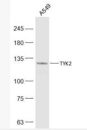 Anti-TYK2 antibody-非受体酪氨酸蛋白激酶2抗体,TYK2