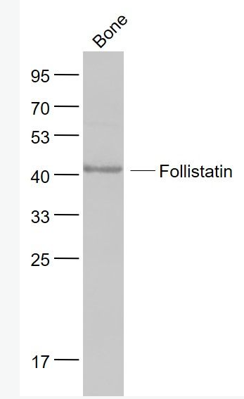 Anti-FS/Follistatin antibody-促卵泡激素抑释素/卵泡抑素抗体,FS/Follistatin