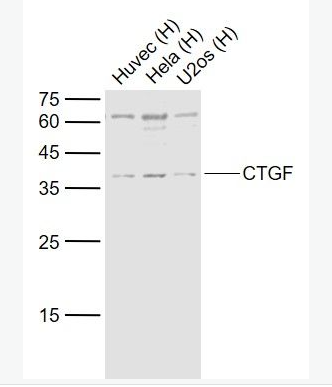 Anti-CTGF antibody-结缔组织生长因子抗体,CTGF