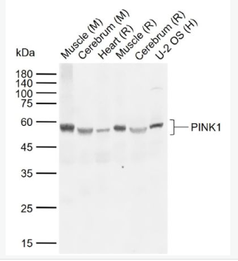 Anti-PINK1 antibody-丝氨酸/苏氨酸蛋白激酶PINK1抗体,PINK1