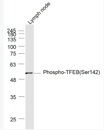 Anti-Phospho-TFEB(Ser142) antibody-磷酸化T淋巴细胞转录调节因子TFEB抗体,Phospho-TFEB(Ser142)