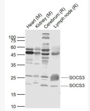 Anti-SOCS3 antibody-细胞因子信号传导抑制蛋白3抗体,SOCS3