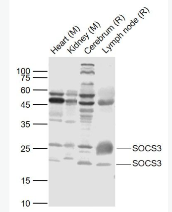 Anti-SOCS3 antibody-細(xì)胞因子信號(hào)傳導(dǎo)抑制蛋白3抗體,SOCS3