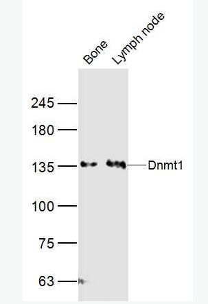 Anti-Dnmt1 antibody-DNA甲基转移酶1抗体,Dnmt1
