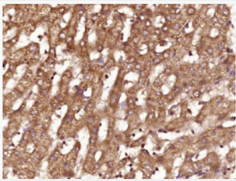 Anti-FGF3 antibody-纤维母细胞生长因子3抗体,FGF3