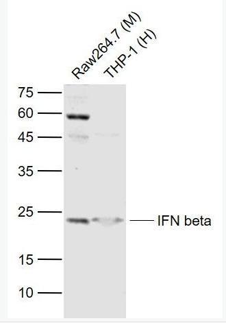 Anti-IFNB1 antibody-干扰素β抗体,IFNB1
