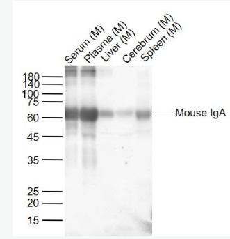 Anti-Mouse IgAantibody-小鼠IgA抗体,Mouse IgA