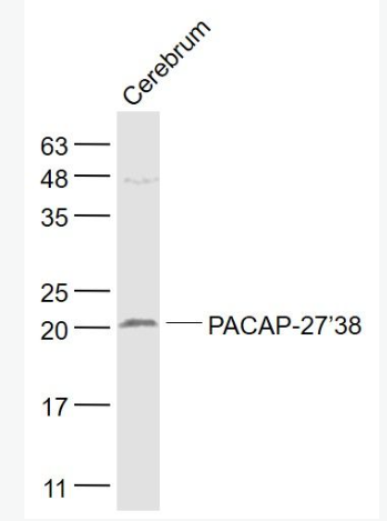Anti-PACAP-27/38 antibody-腺苷酸环化酶激活肽-27/38抗体,PACAP-27/38