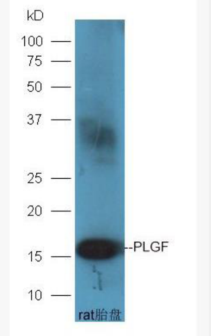 Anti-PLGF antibody-胎盘生长因子抗体,PLGF