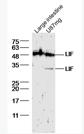 Anti-LIF antibody-白血病抑制因子抗体,LIF