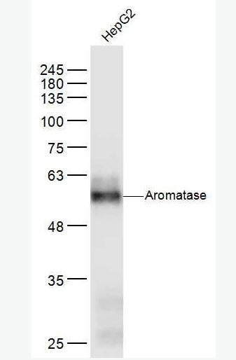 Anti-Aromatase antibody-芳香化酶抗体,Aromatase