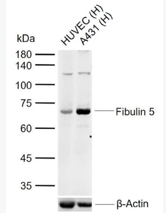 Anti-Fibulin 5 antibody-衰老关键蛋白抗体,Fibulin 5