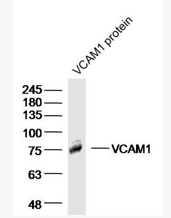 Anti-VCAM1 antibody-血管内皮细胞粘附分子（CD106）抗体,VCAM1