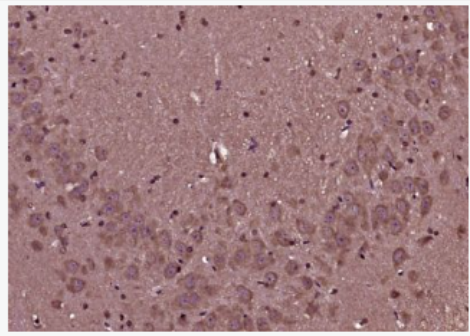 Anti-beta-Amyloid 1-42 (CT) antibody-β淀粉样肽1-42(C端)/β-Amyloid 1-42 (CT)抗体,beta-Amyloid 1-42 (CT)