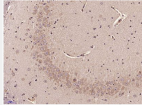 Anti-SOCS2 antibody-细胞因子信号传导抑制蛋白2抗体,SOCS2