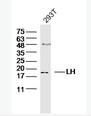 Anti-LHB antibody-促黃體素β亞單位抗體,LHB