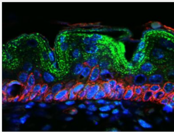 Anti-CCL11 antibody-嗜酸粒細(xì)胞趨化因子/蛋白/Eotaxin抗體,CCL11