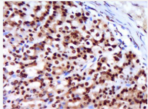 Anti-CCL3  antibody-巨噬细胞炎症因子1α抗体,CCL3