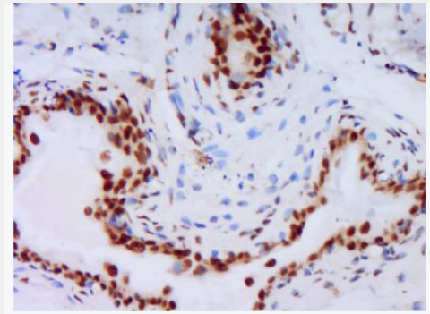 Anti-nNOS antibody-一氧化氮合成酶-1（神经型）抗体,nNOS