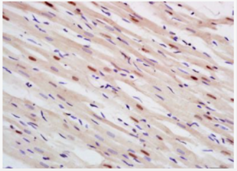 Anti-CSF1 antibody-巨噬细胞克隆刺激因子抗体,CSF1