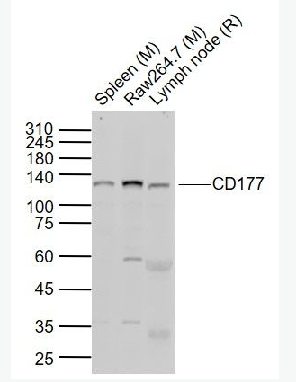Anti-CD177 antibody-嗜中性粒细胞抗原CD177抗体,CD177