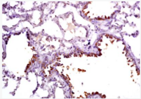 Anti-Uteroglobin antibody-克拉拉細(xì)胞蛋白抗體,Uteroglobin