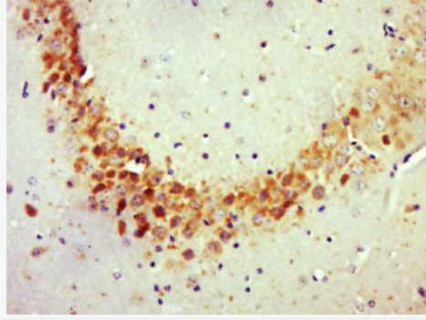 Anti-Rho C antibody-RhoC抗體,Rho C