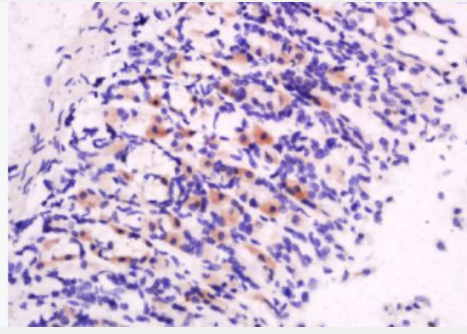 Anti-Motilin antibody-胃动素抗体,Motilin