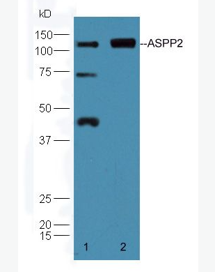 Anti-ASPP2 antibody-P53凋亡刺激蛋白2抗體,ASPP2