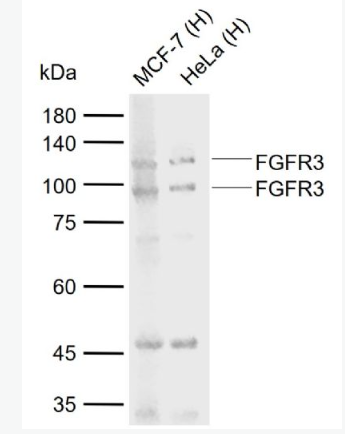 Anti-FGFR3 antibody-成纤维细胞生长因子受体3抗体,FGFR3
