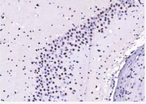 Anti-Cardiac Troponin I/TNNC1 antibody-心肌肌钙蛋白抗体,Cardiac Troponin I/TNNC1