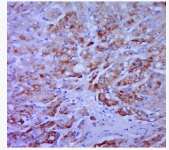 Anti-CCL20 antibody-巨噬细胞炎性蛋白MIP-3a抗体,CCL20