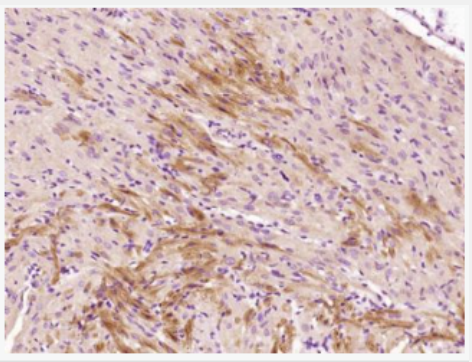 Anti-Selenoprotein W antibody-硒蛋白W抗体,Selenoprotein W