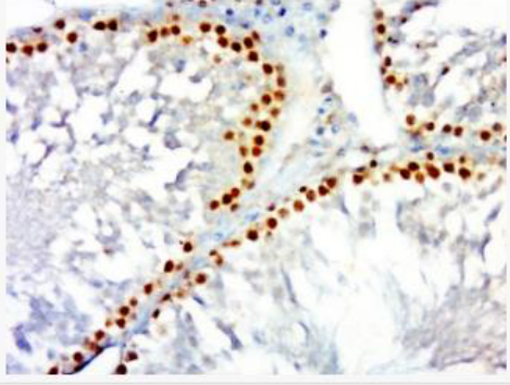 Anti-TNF alpha(1F6) antibody-肿瘤坏死因子-α单克隆抗体,TNF alpha(1F6)