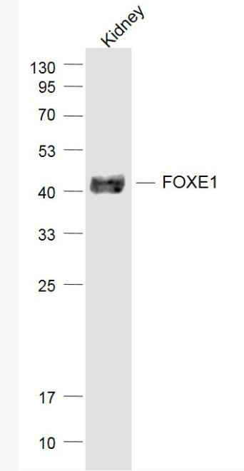 Anti-FOXE1 antibody-甲状腺转录因子-2抗体,FOXE1