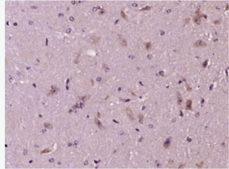 Anti-TGM3 antibody-谷氨酰胺转胺酶3抗体,TGM3