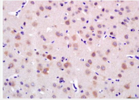 Anti-LRIG1 antibody-LRIG1抗體,LRIG1