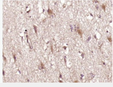 Anti-Vasopressin antibody-抗利尿激素/血管升壓素/加壓素/血管加壓素抗體,Vasopressin