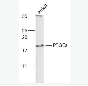 Anti-PTGEs/Prostaglandin E Synthase antibody-前列腺素E合成酶抗体,PTGEs/Prostaglandin E Synthase