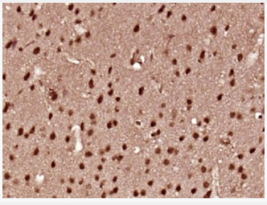 Anti-IL-16 antibody-白介素16抗体,IL-16